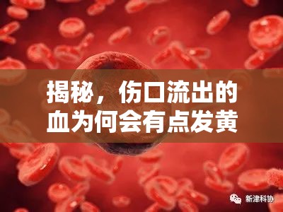 揭秘，傷口流出的血為何會(huì)有點(diǎn)發(fā)黃及其健康警示
