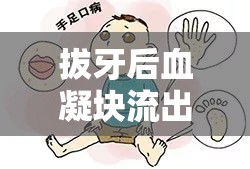 拔牙后血凝塊流出，你需要了解的緊急處理與注意事項(xiàng)