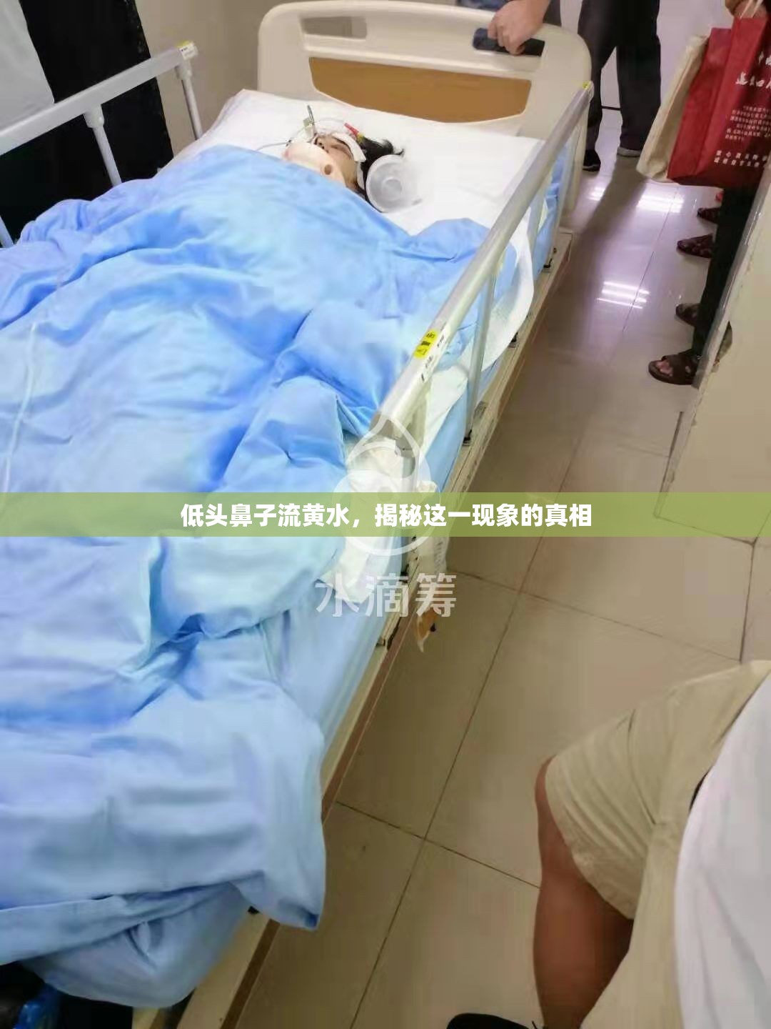 低頭鼻子流黃水，揭秘這一現(xiàn)象的真相