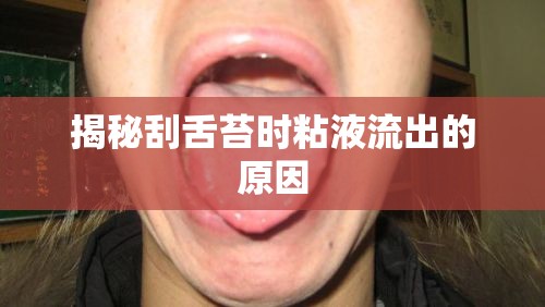 揭秘刮舌苔時(shí)粘液流出的原因