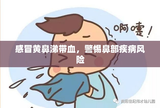 感冒黃鼻涕帶血，警惕鼻部疾病風險