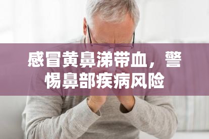 感冒黃鼻涕帶血，警惕鼻部疾病風險