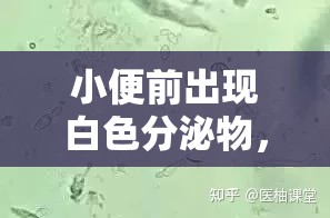 小便前出現(xiàn)白色分泌物，原因與應(yīng)對措施
