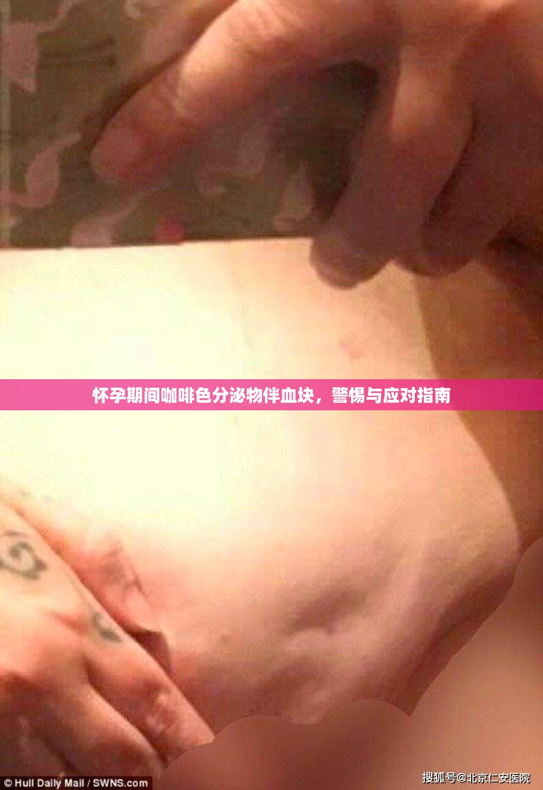 懷孕期間咖啡色分泌物伴血塊，警惕與應對指南