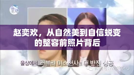 趙奕歡，從自然美到自信蛻變的整容前照片背后