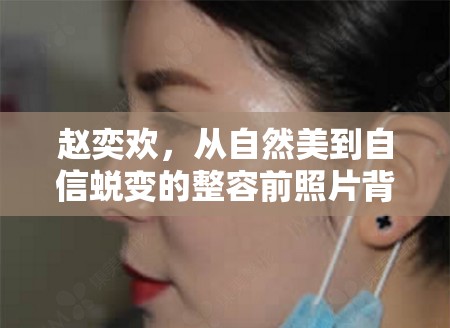 趙奕歡，從自然美到自信蛻變的整容前照片背后