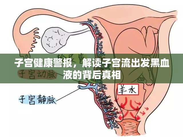 子宮健康警報(bào)，解讀子宮流出發(fā)黑血液的背后真相