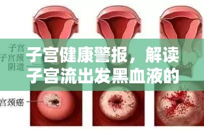 子宮健康警報(bào)，解讀子宮流出發(fā)黑血液的背后真相