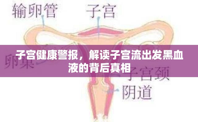 子宮健康警報(bào)，解讀子宮流出發(fā)黑血液的背后真相