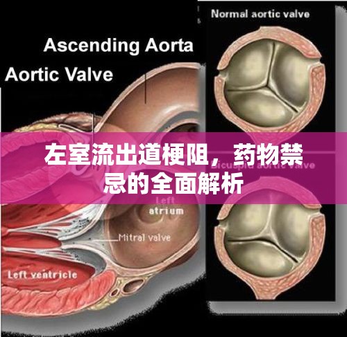 左室流出道梗阻，藥物禁忌的全面解析