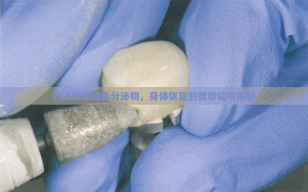 藥流后咖啡色分泌物，身體恢復(fù)的微妙信號(hào)揭秘