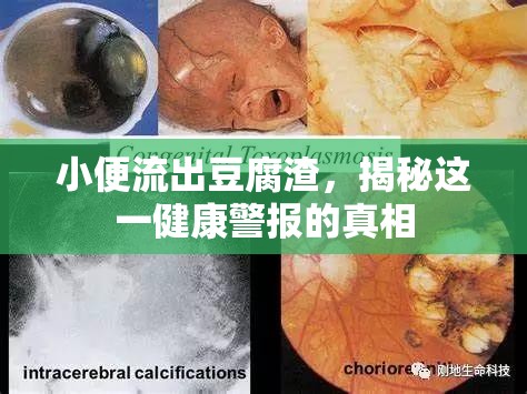 小便流出豆腐渣，揭秘這一健康警報(bào)的真相