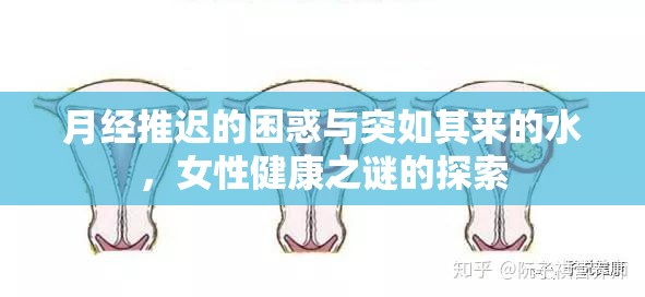 月經(jīng)推遲的困惑與突如其來的水，女性健康之謎的探索