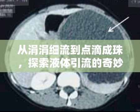 從涓涓細(xì)流到點(diǎn)滴成珠，探索液體引流的奇妙過(guò)程