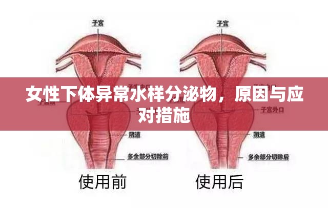女性下體異常水樣分泌物，原因與應(yīng)對(duì)措施