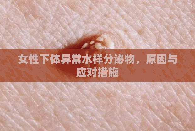 女性下體異常水樣分泌物，原因與應(yīng)對(duì)措施