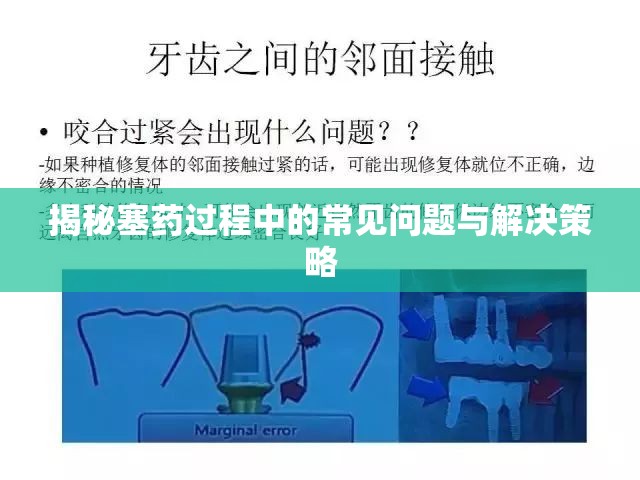 揭秘塞藥過程中的常見問題與解決策略