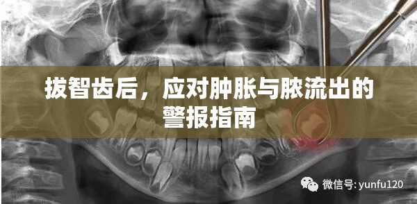 拔智齒后，應(yīng)對(duì)腫脹與膿流出的警報(bào)指南