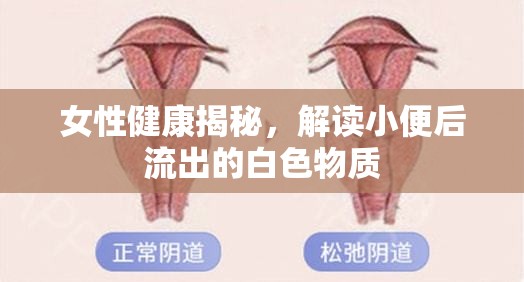 女性健康揭秘，解讀小便后流出的白色物質(zhì)