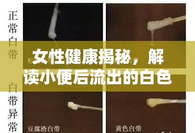 女性健康揭秘，解讀小便后流出的白色物質(zhì)