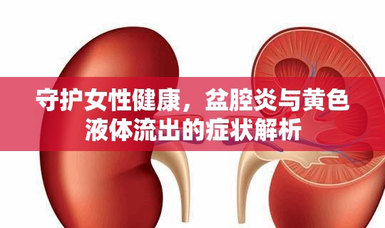 守護(hù)女性健康，盆腔炎與黃色液體流出的癥狀解析