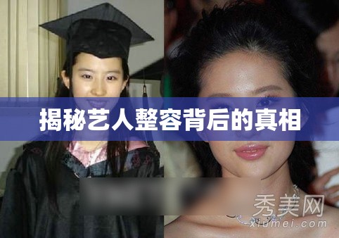 揭秘藝人整容背后的真相