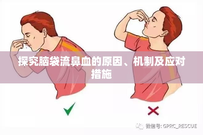 探究腦袋流鼻血的原因、機(jī)制及應(yīng)對措施