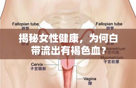 揭秘女性健康，為何白帶流出有褐色血？