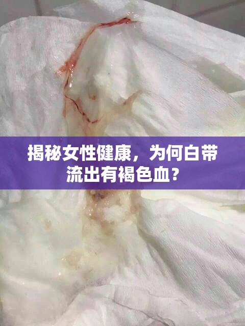 揭秘女性健康，為何白帶流出有褐色血？