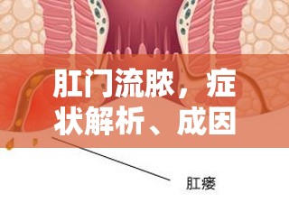 肛門流膿，癥狀解析、成因探討及合理用藥指南