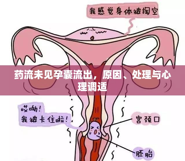 藥流未見孕囊流出，原因、處理與心理調(diào)適
