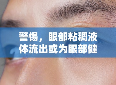 警惕，眼部粘稠液體流出或?yàn)檠鄄拷】稻瘓?bào)