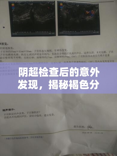 陰超檢查后的意外發(fā)現(xiàn)，揭秘褐色分泌物背后的真相