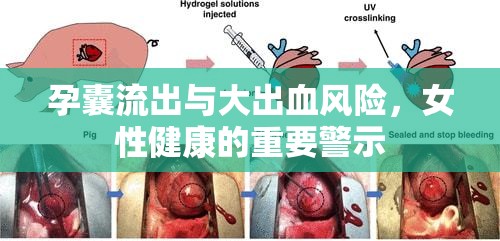 孕囊流出與大出血風(fēng)險(xiǎn)，女性健康的重要警示