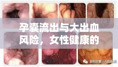孕囊流出與大出血風(fēng)險(xiǎn)，女性健康的重要警示