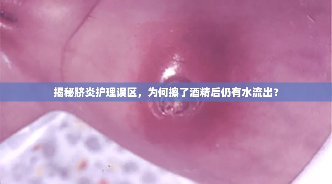 揭秘臍炎護理誤區(qū)，為何擦了酒精后仍有水流出？
