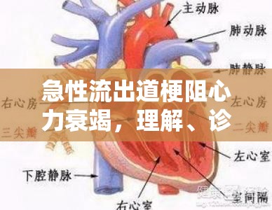 急性流出道梗阻心力衰竭，理解、診斷與應(yīng)對(duì)策略