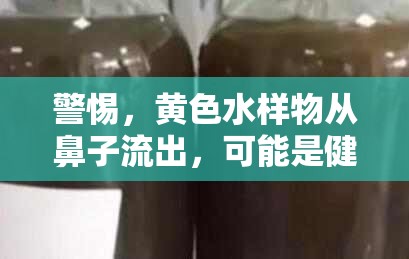 警惕，黃色水樣物從鼻子流出，可能是健康警報(bào)