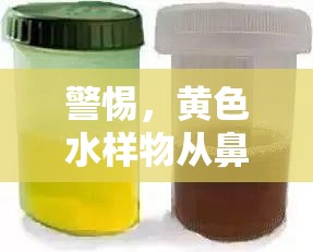 警惕，黃色水樣物從鼻子流出，可能是健康警報(bào)