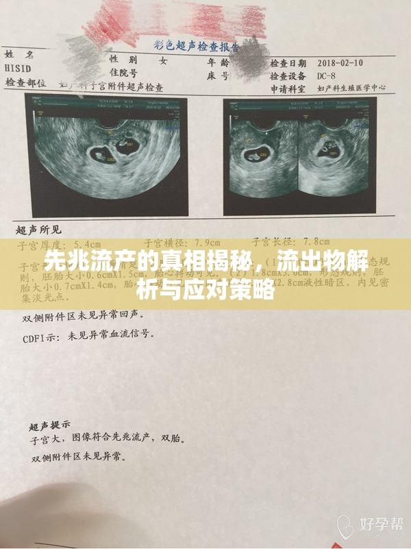 先兆流產(chǎn)的真相揭秘，流出物解析與應(yīng)對(duì)策略