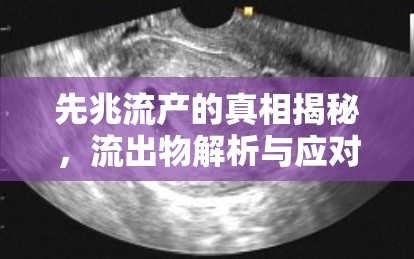 先兆流產(chǎn)的真相揭秘，流出物解析與應(yīng)對(duì)策略