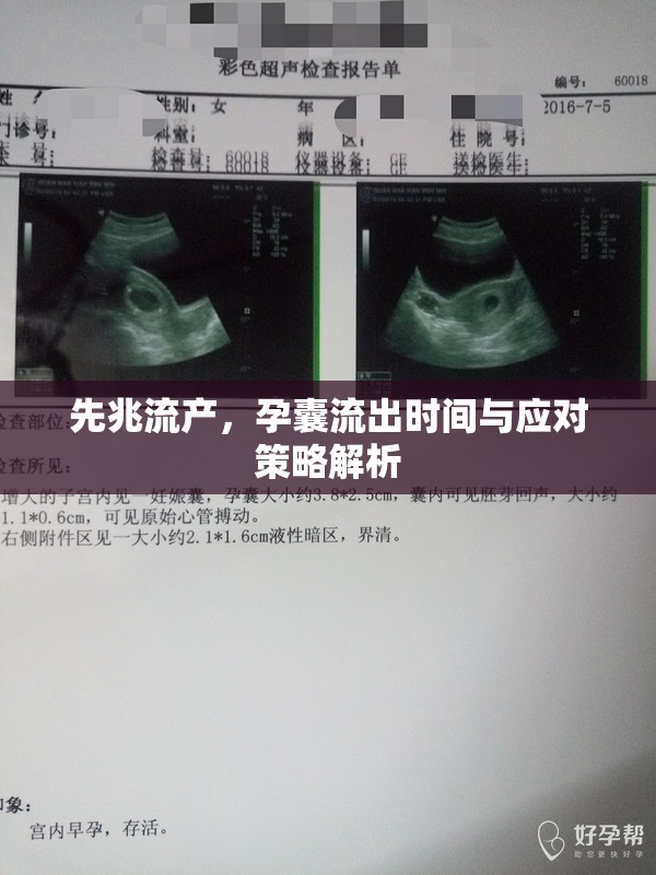 先兆流產(chǎn)，孕囊流出時間與應對策略解析