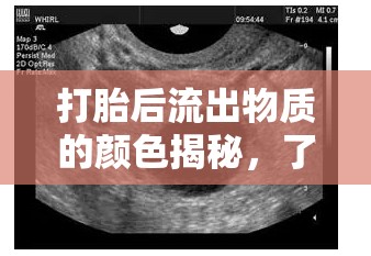打胎后流出物質(zhì)的顏色揭秘，了解真相，理性面對(duì)