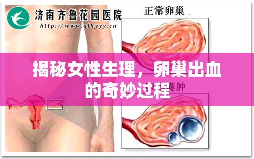 揭秘女性生理，卵巢出血的奇妙過程