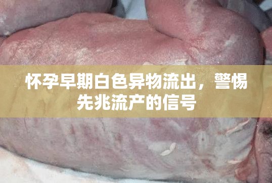 懷孕早期白色異物流出，警惕先兆流產的信號