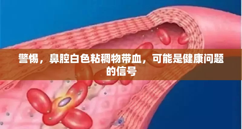 警惕，鼻腔白色粘稠物帶血，可能是健康問題的信號(hào)