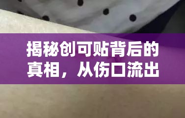 揭秘創(chuàng)可貼背后的真相，從傷口流出的液體究竟是什么？