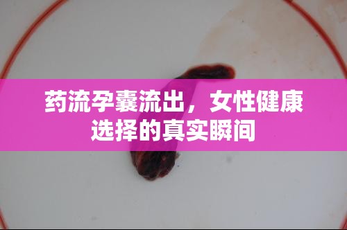 藥流孕囊流出，女性健康選擇的真實(shí)瞬間