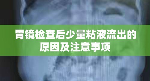 胃鏡檢查后少量粘液流出的原因及注意事項(xiàng)