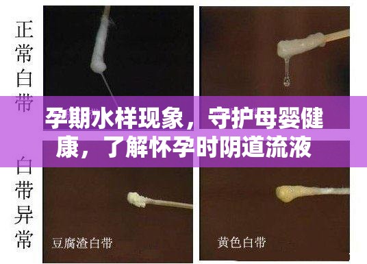 孕期水樣現(xiàn)象，守護母嬰健康，了解懷孕時陰道流液
